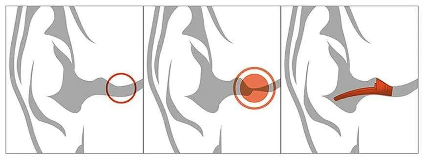 EQ Ear Plugs